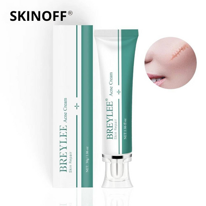 BREYLEE Skin Repair