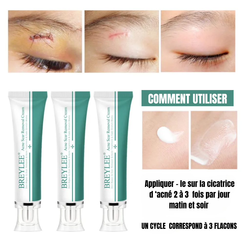 BREYLEE Skin Repair